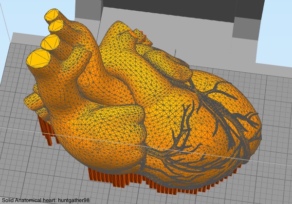 Simplify3D - heart model with mesh and supports