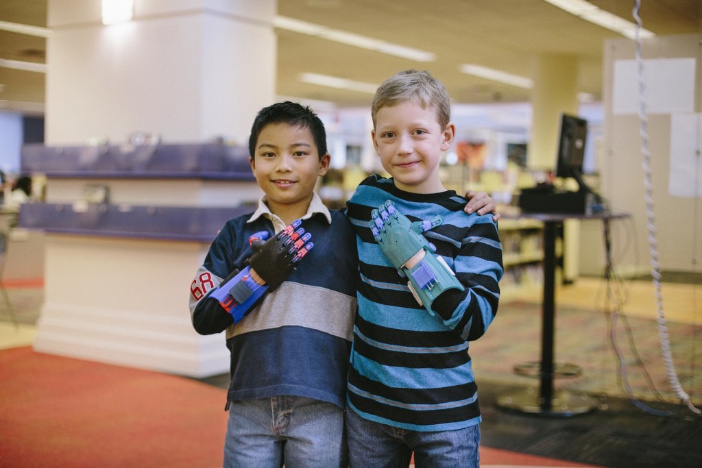 Simplify3D - boys with 3D printed prosthetic limbs